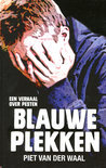 Afbeelding van Blauwe plekken